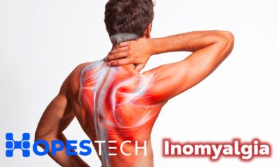 Inomyalgia