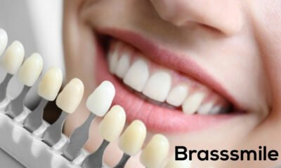 Brasssmile
